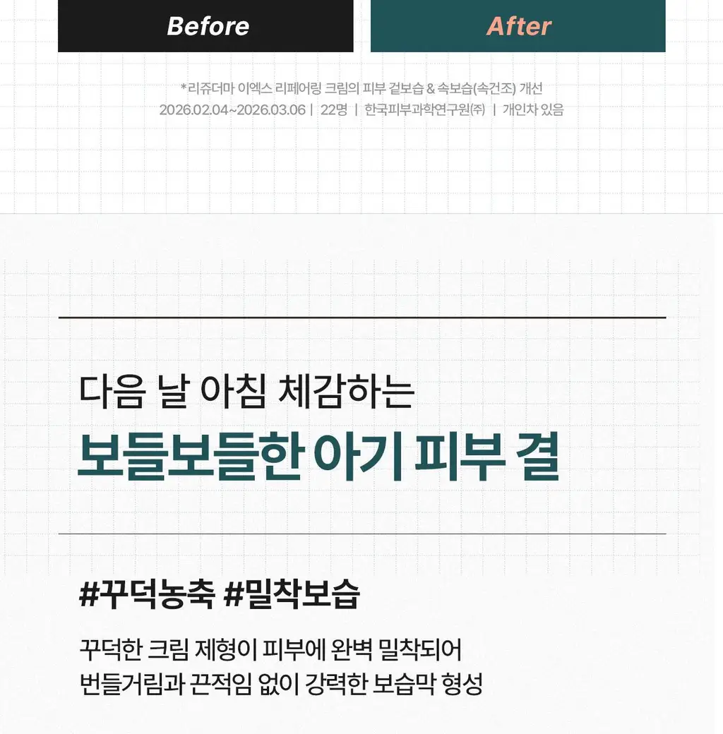 [최모나PICK][리쥬란 제약사_4배속 급속진정] 리쥬더마 EX 리페어링 크림 20g 상세페이지 17